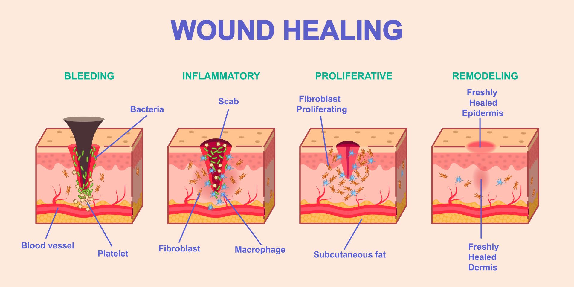 Wound Healing Graphic